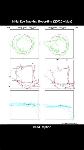Initial eye tracking with 20/20 vision vs