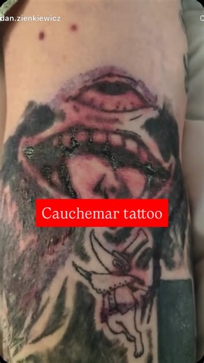 Visceral Aurore on Instagram: "🔴 Causes possibles 1. Infection bactérienne • Rougeur intense • Gonflement • Zones noires/verdâtres croûteuses • Douleur importante • Écoulement ou odeur → Ça peut arriver si les soins n’ont pas été faits correctement ou si le matériel n’était pas parfaitement stérile. 2. Réaction allergique à l’encre • Certaines encres (surtout rouges, vertes, noires de mauvaise qualité) peuvent provoquer une réaction inflammatoire sévère. 3. Sur-travail de la peau • Si le tatoue