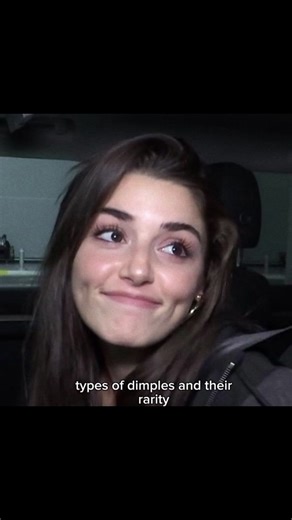 Explore the Different Types of Dimples and Their Rarity