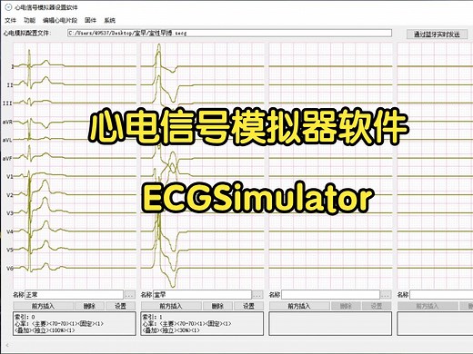 心电信号模拟器ECGSimulator 心电信号模拟仪 心电信号发生器