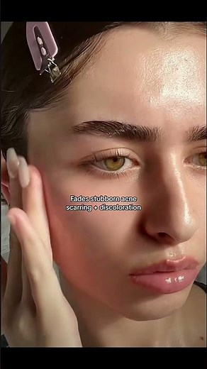 Anua Niacinamide 10% + TXA 4% Serum Review ✨️
