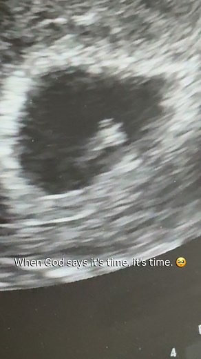 I TOOK A PREGNANCY TEST 5 DAYS BEFORE MY MISSED PERIOD— only because it was expiring that day. I thought, “Sayang naman”. I wasn’t expecting anything. Before I even took the test, I prayed. I told God, “Even if it’s not positive, it’s okay. I’ll trust Your timing.” And for the first time in years, I truly meant it. No heaviness, no fear, just full surrender and peace. In 2021, I had a blighted ovum. In 2022, I lost my brother, Pedro. I was still healing, and maybe God knew my heart wasn’t ready 