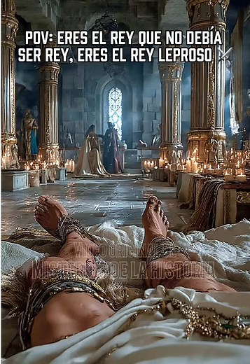 Despertar como Rey Leproso: Una Narrativa Histórica