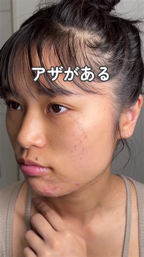 アザを隠すためにしてたメイクも、 今では「もっと自分を好きになるため」に変わった。 人生一度きり。 一緒に、“好きな自分”を楽しもう🌷 #おすすめ#fyp #皮膚管理#マインド#垢抜け