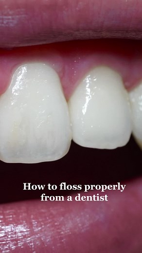 Correct way to floss #hygienetips | water flosser