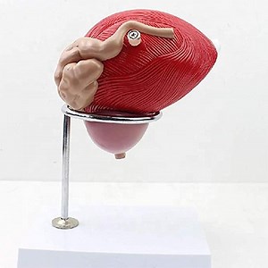 [Hot Item] Enlarge 3X Genitourinary System Anatomical Male Bladder Prostate Model