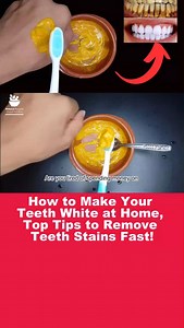 11K views · 43 reactions | How to Whiten Your Teeth at Home Fast |...