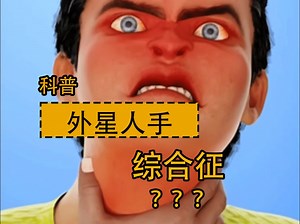 什么是外星人手综合征？失去肢体后，为何会产生幻肢痛？
