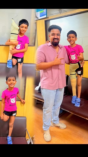 Her Smile 💗 | Artificial Leg | Prosthetic Leg for Kids | Above Knee Amputation | # # #naklitang #prosthetistorthotist #designerprosthetics #abovekneesocket #customprostheticsocket #prosthetics #artificiallimbs | Credence Prosthetic India Pvt. Ltd.