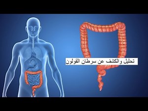 تحليل واكتشاف سرطان القولون والامعاءالمبكر (M2-PK ( schibo