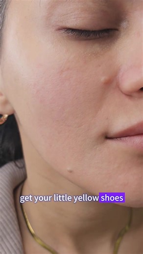 That $300 salon bill? CANCELED. 💸 Watch how this tiny pen erases my skin flaws in seconds. 👀 Safe, effective, and SO affordable. Your journey to clear skin starts now! 🚀 #BeautyTool #SkincareRoutine #WorthIt #SaveMoney #SkinTreatment #AcneSpot #BeautyTech #SmartBeauty #TikTokShopBlackFriday