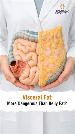 Visceral Fat: More Dangerous Than Belly Fat - Dr. A. Guru Prakash