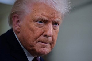 Trump explains bizarre explanation for how his hands keep bruising