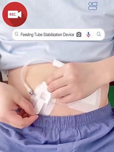 Foley Catheter Stabilization Device for PEG/J/Feeding Tube Holder Accessories, Adhesive Bandages Urinary Leg Bag Sticker Dialysis Drain Cath Stabilizer (Pack of 20)