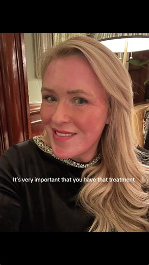 Fully Ablative laser 17 weeks on #skintransformation #sundamagedskin #c02laserresurfacing #genxwomen #newyearnewme