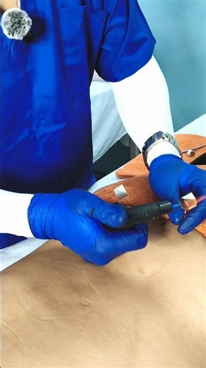 Back Pain? Try This Simple Acupuncture Technique #shorts #BackPain #LowerBackPain #yt