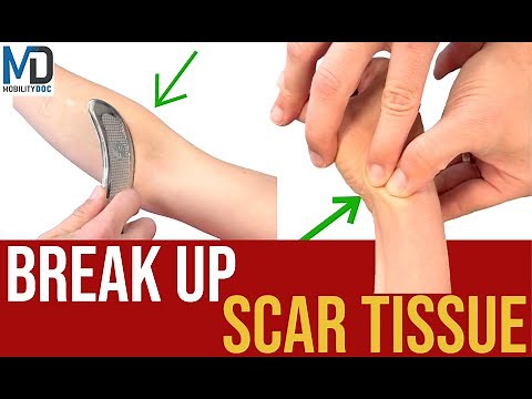 How To Break Up Scar Tissue - 6 Effective Methods