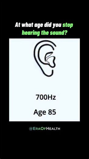 Your hearing isn’t just about your ears - it’s about your brain. High-frequency sounds are often the first to fade with age. But hearing loss isn’t just an inconvenience - it’s a warning sign. The research: * Age-related hearing loss is linked to accelerated brain shrinkage, cognitive decline, and dementia risk (Johns Hopkins Medicine, 2014). * Poor hearing increases social isolation , which raises risks of depression and even early death (The Lancet, 2020). * Inner ear damage comes from noise e