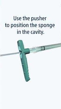 Eso- & Endo-SPONGE: Step-by-Step Preparation and Intracavitary Placement Guide | Boston Scientific