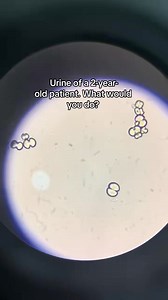 Urine sample 😲😲❤️🔬 #medicallaboratoryscience #microbiology #laboratorymedicine | Lab life