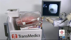 Edmonton gets 1st mobile lung transfer device