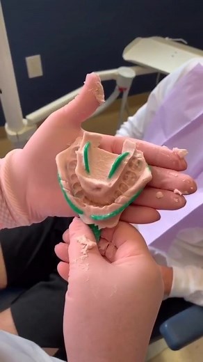 here’s how to make a retainer 😁👀 #orthodontist #retainer #smile