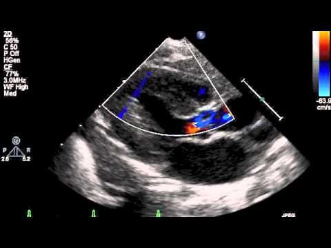 How to do pediatric echocardiography study