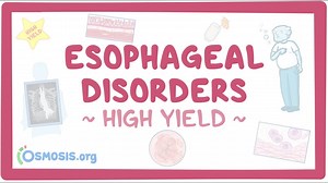Esophageal disorders: Pathology review: Video, Causes, & Meaning | Osmosis
