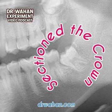 Sectioned off the Crown with Dr. Wahan