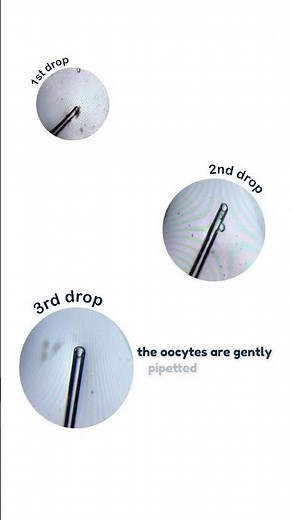 Oocyte Denudation - Lab Procedures | #newlifeivfgreece