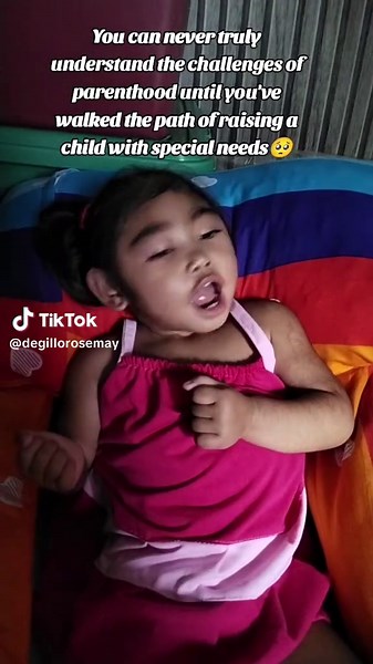 Raising a Child with Microcephaly: Our Journey