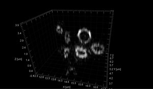 File:3D-SIM-Super-Resolution-Microscopy-Reveals-a-Bead-Like-Arrangement-for-FtsZ-and-the-Division-pbio.1001389.s005.ogv - Wikimedia Commons