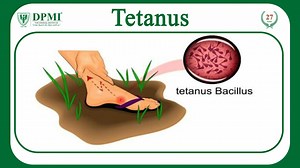 1.7K views · 29 reactions | Tetanus (Lockjaw): What is Tetanus Caused...