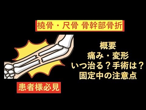 リハビリするなら知っておきたい腕の骨折（橈骨尺骨骨幹部骨折）の概要（症状、痛み、変形、いつ治るか、手術するかしないか、固定中の注意点）