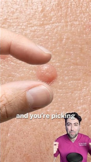 This pimple isn’t what you think it is…
