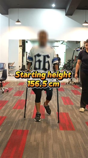 Walking Progress After 3.5 Months | Height Increase Surgery | Limb Lengthening Surgery in India