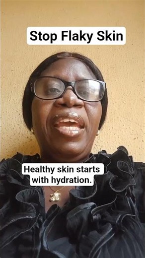 How to Fix Flaky Skin Naturally #flakyskin
