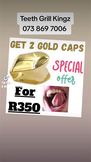 Gold Dental Cap Showcase from Teeth Grill Kings