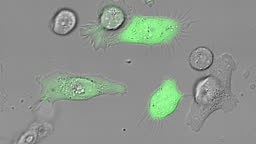 PC-3 human prostate cancer cell line is one of the cell lines used in...