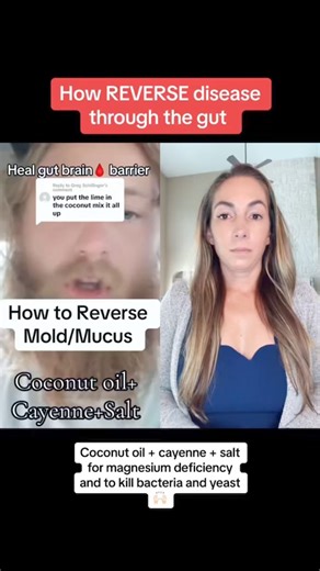 2M views · 61K reactions | Often referred to as the "Second Brain,"...