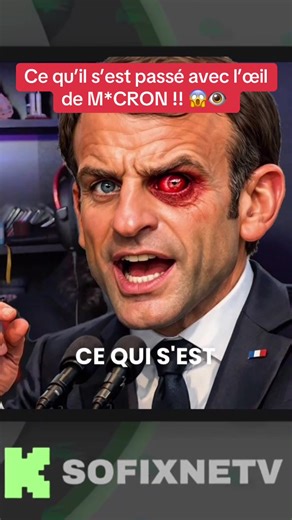 Les théories du Black Eye Panda autour de M*cron