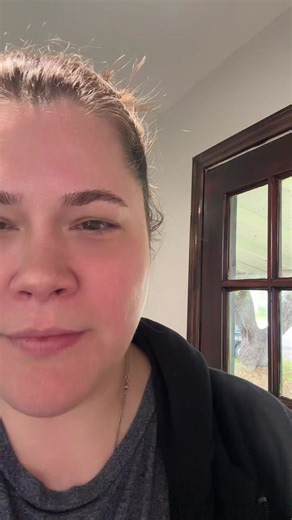 Philodendron White Knight Care Tips