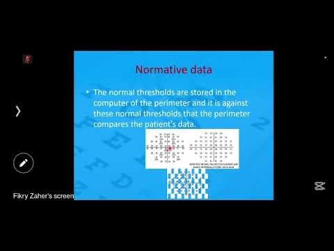 Interpretation of automated visual field and is relation with OCT