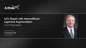 UCL Repair with InternalBrace™ Ligament Augmentation