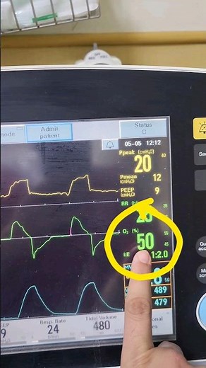 How to check the fio2 set in Ventilator and how much your patient is getting #mohdsaif #anaesthesia