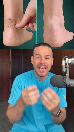 USE OF COMPEED ON THE FEET #podiatry