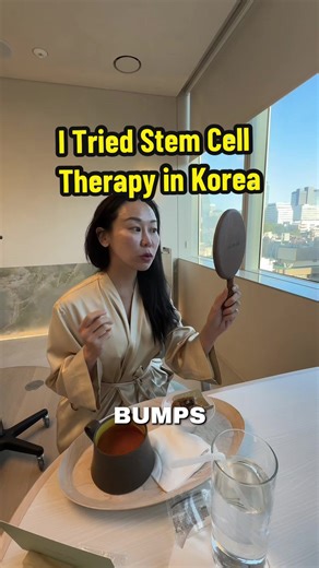 Sharing my personal experience with getting stem cells through IV and targeted injections in my skin. For me, the results are subtle, not a dramatic transformation, but a an upgrade in smoothness, clarity, and overall glow. There’s a lot of gray area with stem cell treatments. Regulations vary by country, and research is still evolving. This is not medical advice. Always talk to someone qualified before making decisions about your health. #koreanskincare #kbeauty #stemcell #salmondna #koreaplast