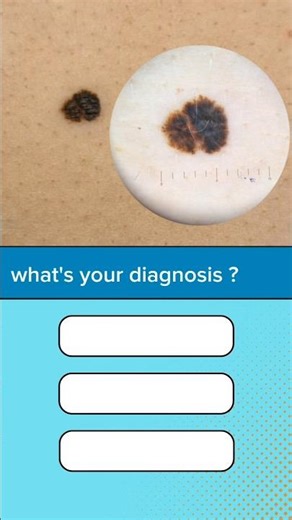 Dermoscopy quiz 2 #dermatology #medstudent