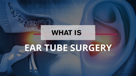 1K views · 13 reactions | Did you know that the placement of ear tubes is the most common surgery in the U.S for kids? Loyola Medicine otolaryngologist Richard Hubbell, MD, describes the procedure and how it can reduce ear infections and improve a child's quality of life. | Loyola Medicine | Facebook