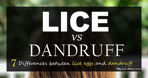 Lice vs Dandruff - 7 Key Differences Between Lice Eggs and Dandruff